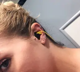 Shows the SwimEars in the ear